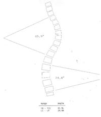 scoliosis analysis